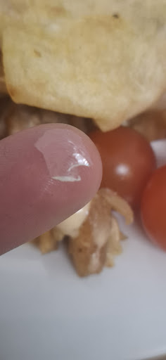 Photo of Folkestone Kebab & Pizza House - 5, Majestic Parade, Sandgate Rd, Folkestone CT20 2BZ